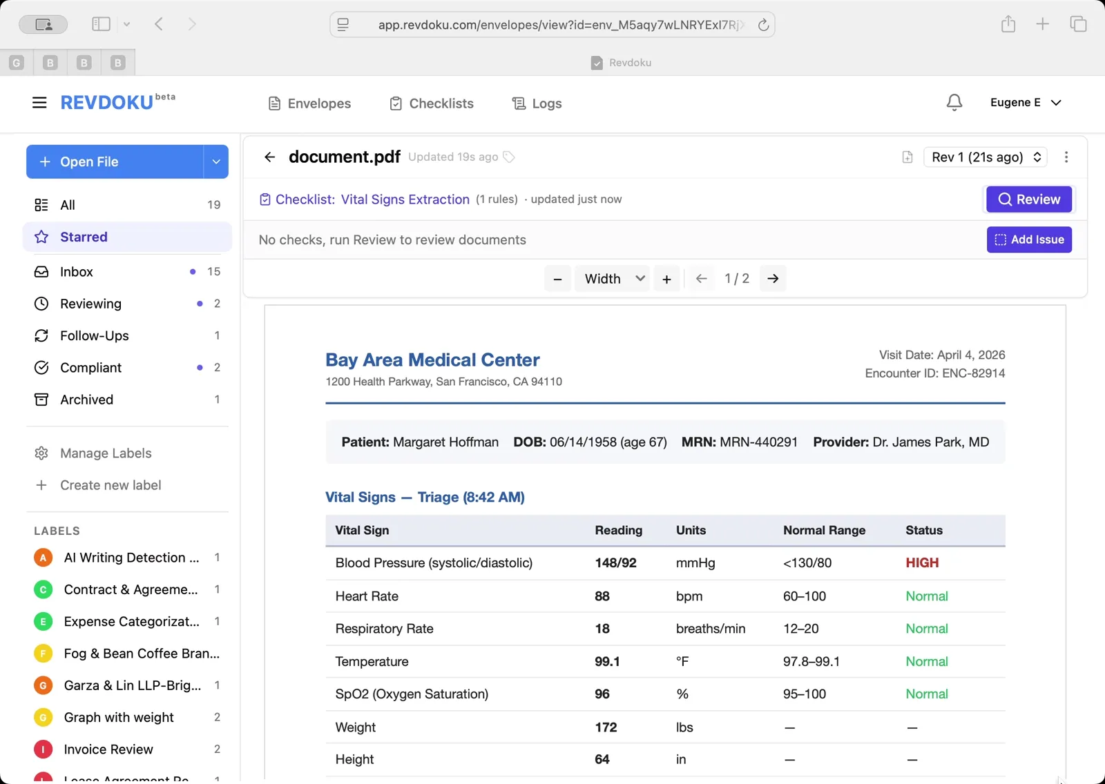 Open the clinical note. A Bay Area Medical Center encounter note for patient Margaret Hoffman is open, with a Vital Signs — Triage table listing blood pressure 148/92 (flagged HIGH), heart rate 88, SpO2 96%, and more.