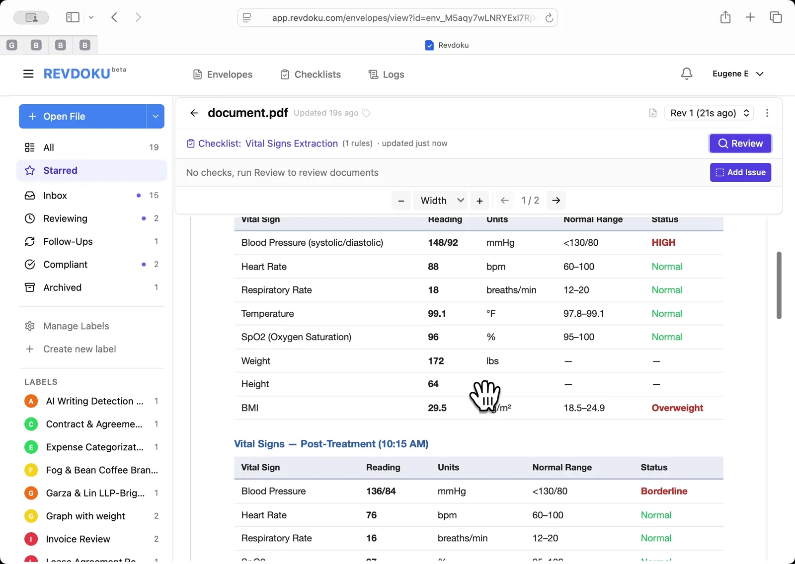 Scroll to see both vitals tables. The Triage and Post-Treatment vitals sections are visible side by side, making it easy to compare readings before and after treatment.